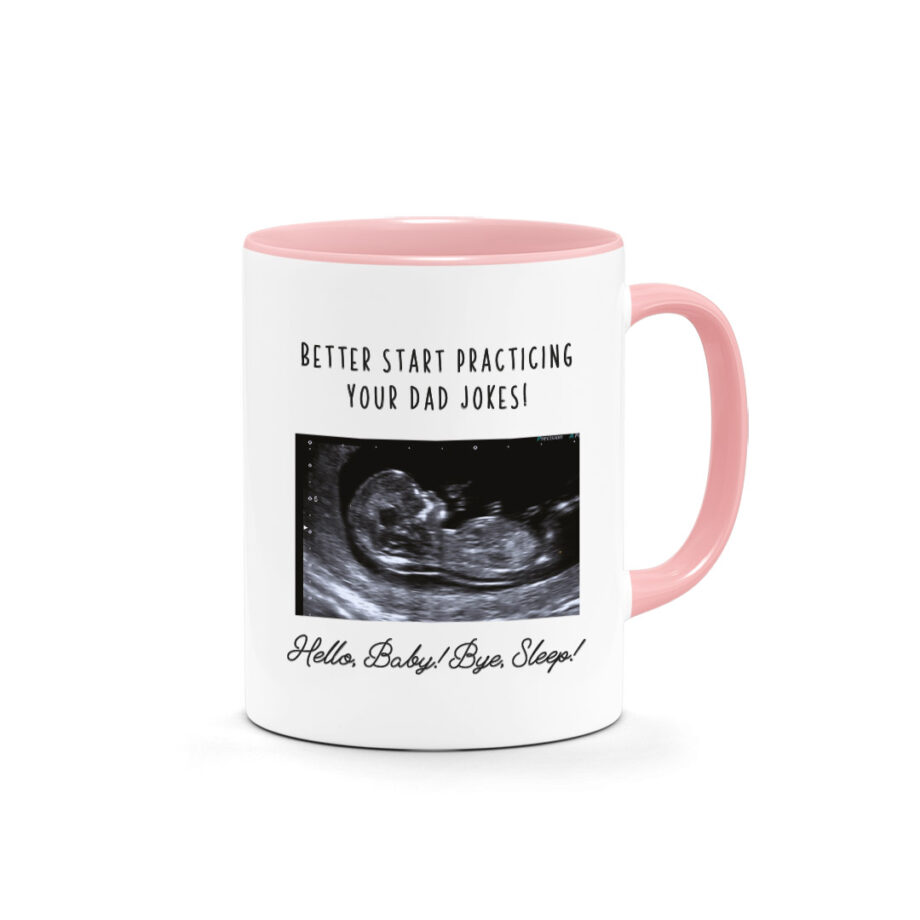 [Custom Text] Father’s Day Printed Mug – Baby Ultrasound Photo Mug Design